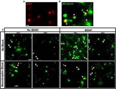 Age Related Response of Neonatal Rat Retinal Ganglion Cells to Reduced TrkB Signaling in vitro and in vivo